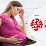 Анемия – наиболее частая патология, выявляемая  у беременных.